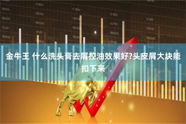 金牛王 什么洗头膏去屑控油效果好?头皮屑大块能扣下来